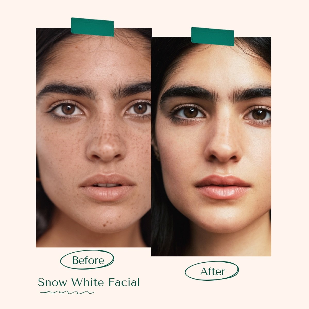 Snowhite Facial