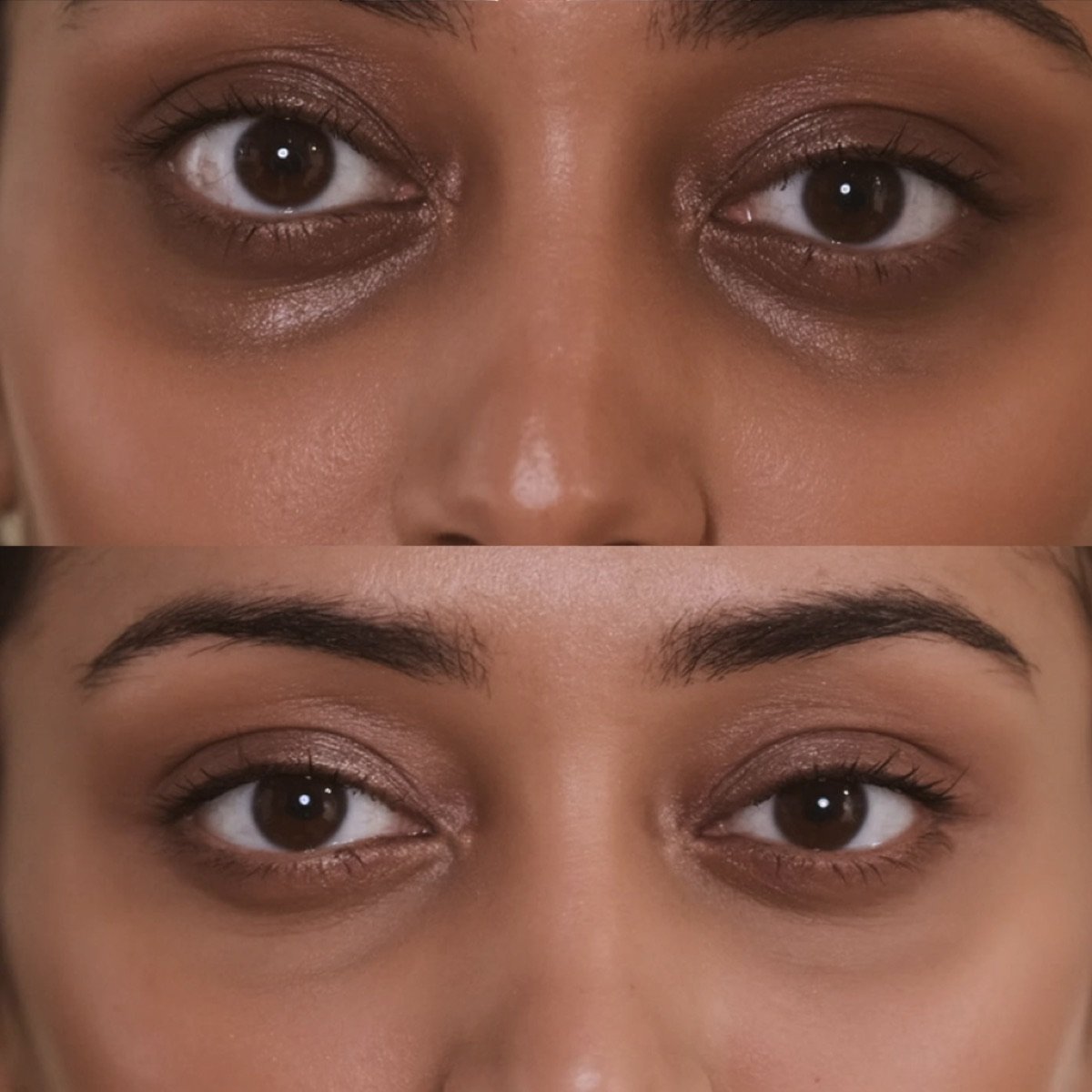 Under Eye Brightening