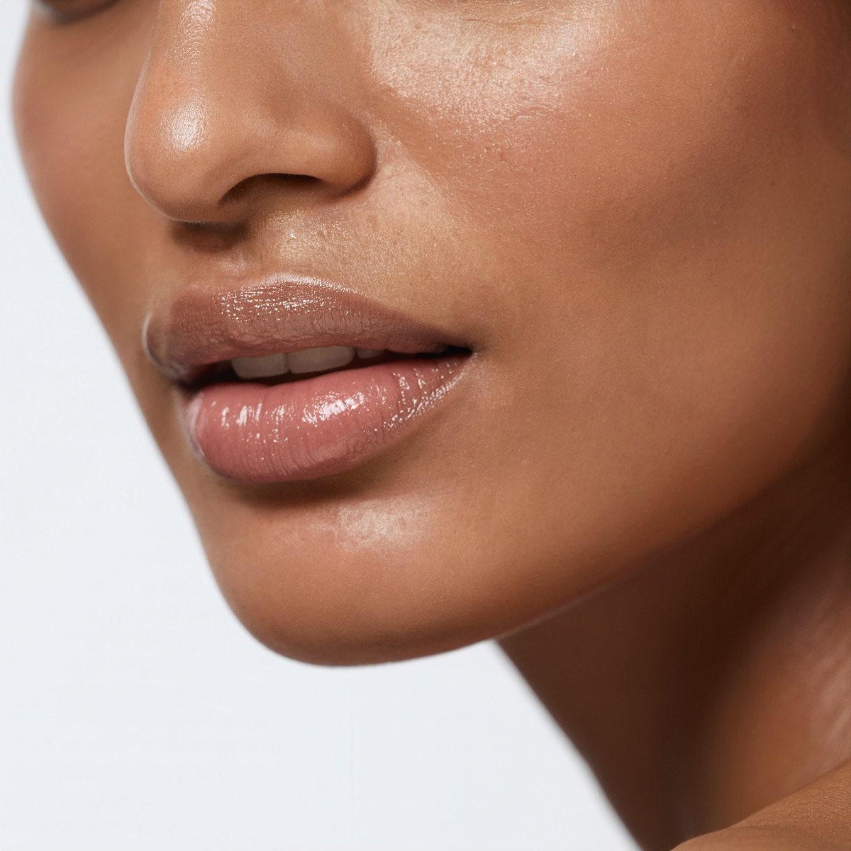 Upper Lip & Chin LHR